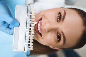 5 Benefits Of Porcelain Veneers